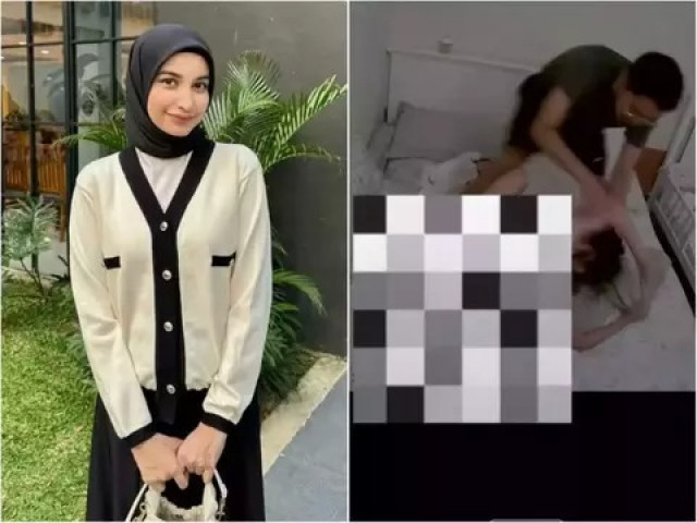 Jadi Korban KDRT, Begini Kondisi Terkini Selebgram Intan&nbsp;Nabila